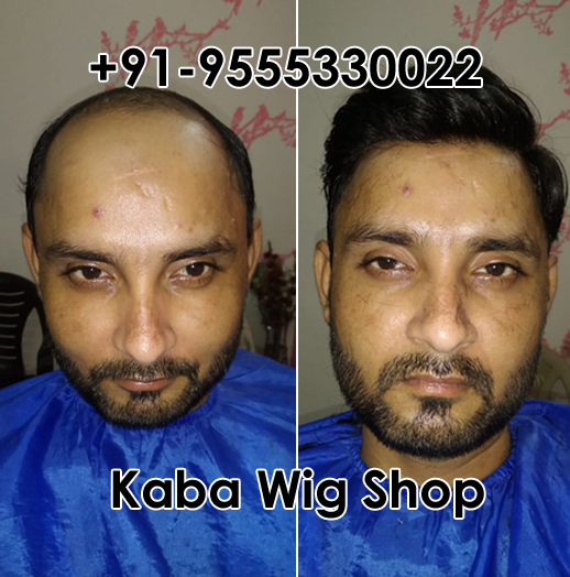 Hair Bonding in Tilak Nagar